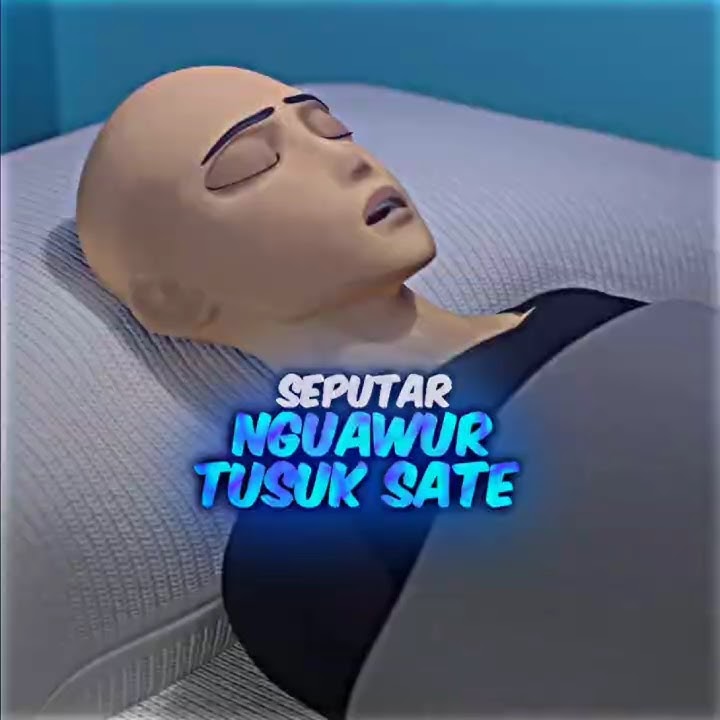 Botak Meninggal Gara' Ini😢🥀