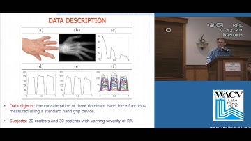Elastic Functional Data Anaylsis Framework for Preoperative Evaluation: Rheumatoid Arthritis