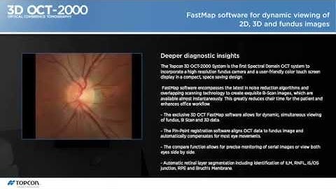 Topcon 3D OCT 2000 demo movie