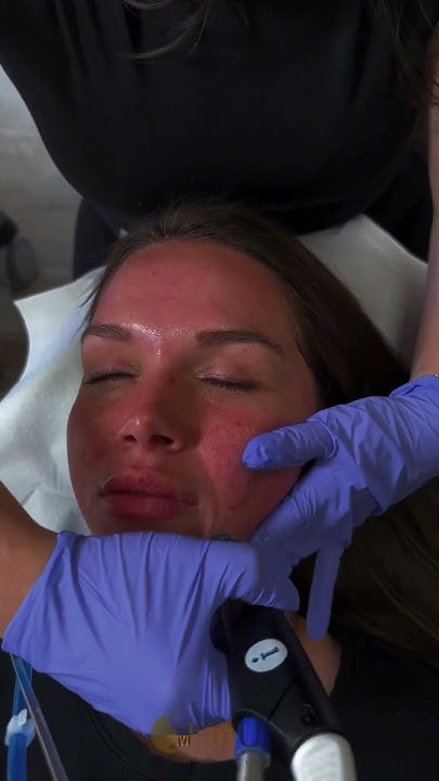 Sometimes We Need A Self Care Day Book Your Hydrafacial At Chin Up sometimes-we-need-a-self-care-day-book-your-hydrafacial-at-chin-up