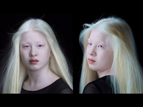Родители отказались от неё, а через 16 лет она стала популярной моделью. История китаянки-альбиноса!