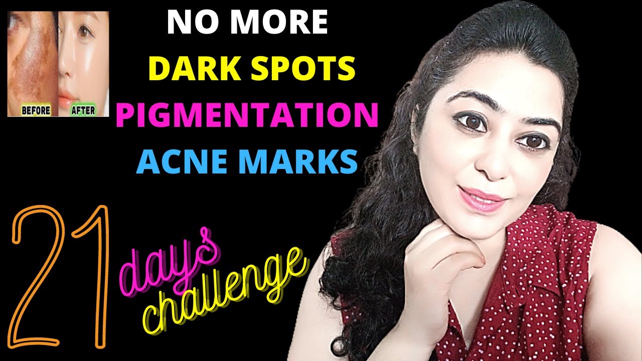 चेहरे के दाग धब्बे,झाइयों से छुटकारा: Remove Dark Spots, Pigmentation, Blemishes, Get Glowing Skin