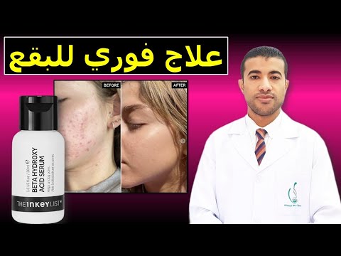 ذا انكي ليست سيروم علاج الرؤوس السوداء والمسام الواسعة روعة     2 