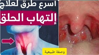 علاج التهاب #الحلقA natural recipe for treating #sore throat