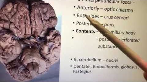 Dr. Pratheepa’s tutorial- Brain spotters 1