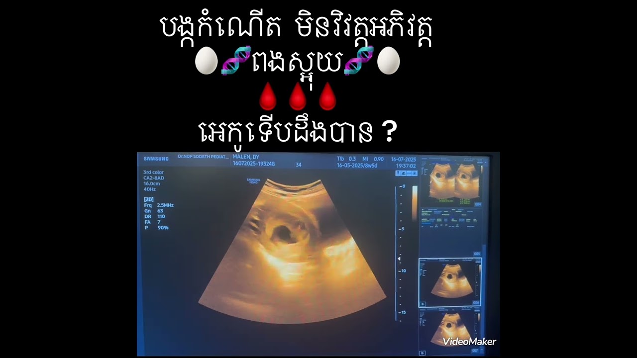 ផ្ទៃពោះ មិនវិវត្តអភិវត្ត ទៅ ពងស្អុយ