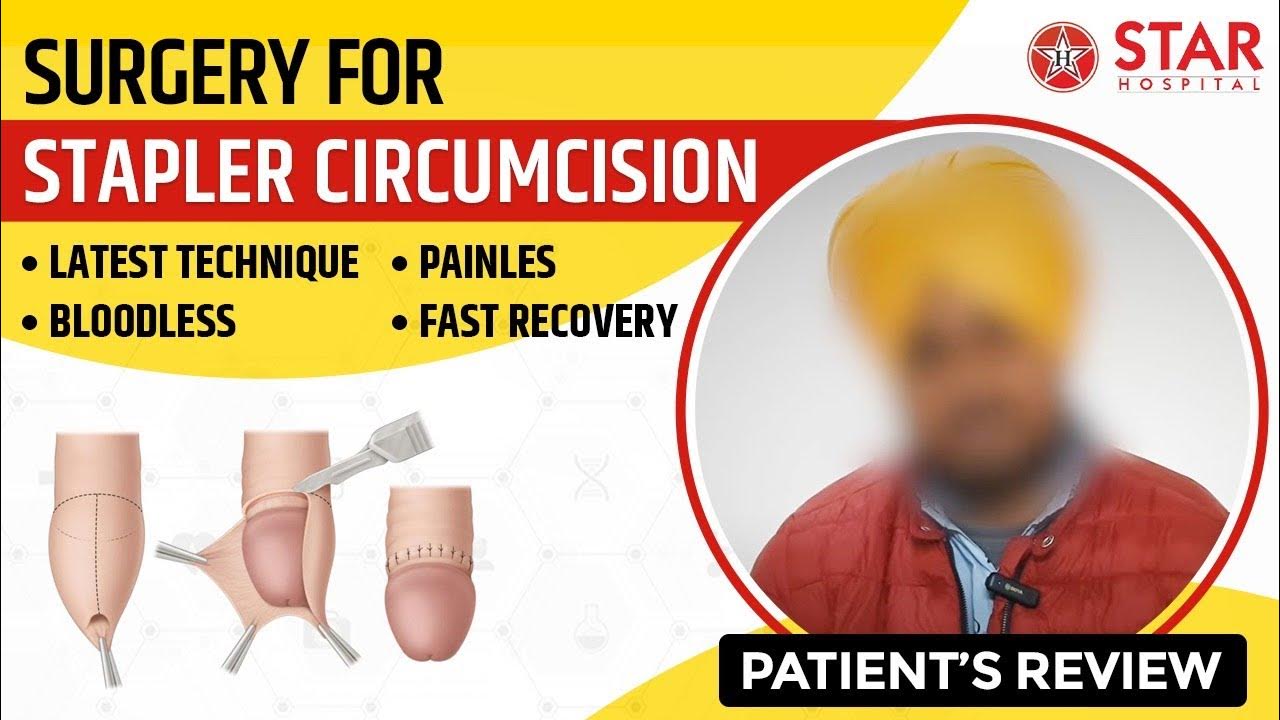 stapler-circumcision-zsr-jalandhar-punjab-best-hospital-bloodless
