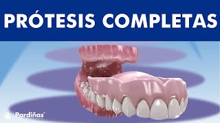 Prótesis completa removible o dentadura postiza -  Información y cuidados ©