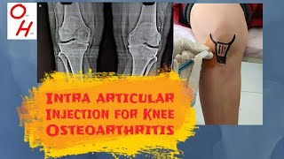 Intra articular Injection for Knee Osteoarthritis