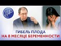 Антенатальная гибель плода на 8 месяце беременности. Как не допустить повторения. Гузов И.И.