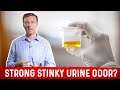 Pee Smells Bad? What Causes Strong Stinky Odor After Urination? - Dr.Berg