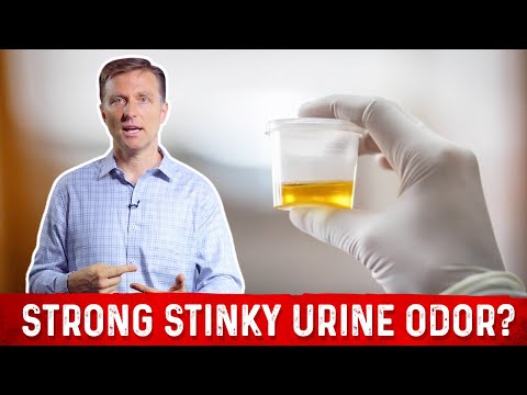 Why Does My Urine Have a Strong Stinky Odor?