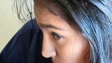 Heavy lice removel#with real sound#pls#viral#youtube