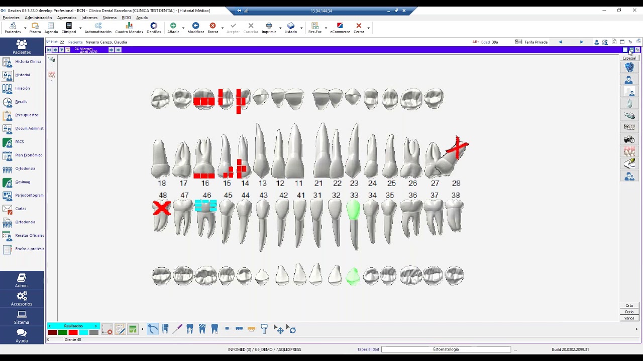 Formación - Odontograma al detalle