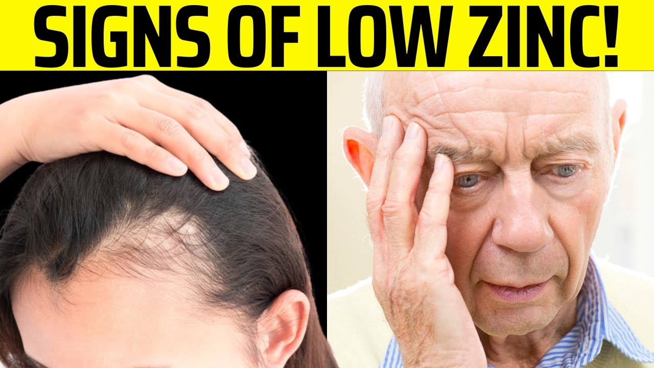 10 Signs Your Body Is Begging For Zinc YouTube