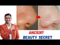 Blackheads , Whiteheads 100% Natural Home Remedy | Get Crystal Clear Skin naturally at home