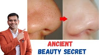 Blackheads , Whiteheads 100% Natural Home Remedy | Get Crystal Clear Skin naturally at home screenshot 5