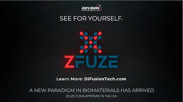 ZFUZE™: A New Biomaterial Revolutionizing Spine Fusion and Revision Surgeries
