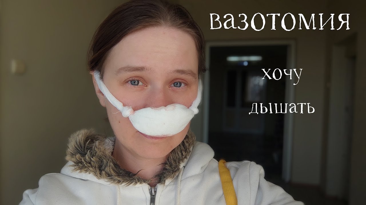 Я это сделала! Оперативное лечение вазомоторного ринита. Вазотомия ...