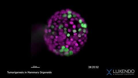 Tumorigenesis Mammary Organoids2