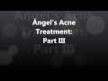 Ángel's Acne Treatment: #3