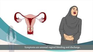 سرطان عنق الرحم - cervical cancer