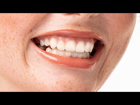 What Does It Mean When Your Gums Are White