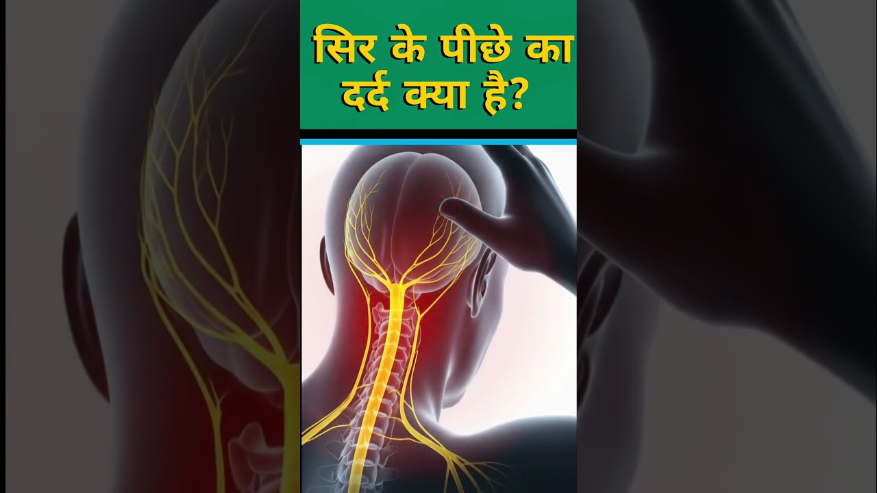 सिर के पिछले हिस्से में दर्द | सिर के पीछे दर्द का कारण | SIR ME DARD KA KARAN #headpain