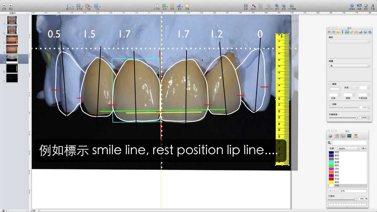 DSD episode 4 Transfer To Study Cast YouTube