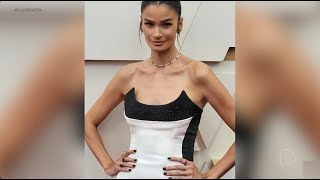 Modelo Carol Ribeiro anuncia diagnostico de esclerose múltipla, entenda sobre a doença autoimune