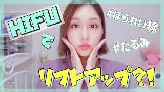 Trying out a HIFU (High-Intensity Focused Ultrasound) home facial
