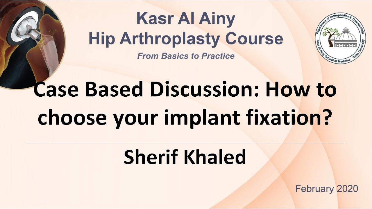 1-8 How to choose your implant fixation - Sherif Khaled