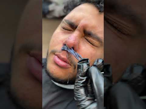 ازاله البقعه السوده من المماخير         