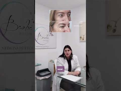 polinucleotidos - anti-aging #skincare #belleza