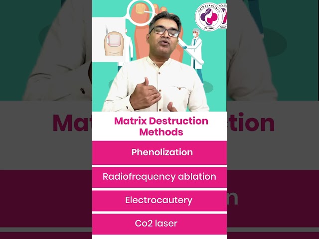Ingrown Toenail Treatment | Lateral Matricectomy Surgery for Ingrown Toenail | Dr. Sunil Kothiwala