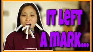 CLOTHESPIN CHALLENGE!