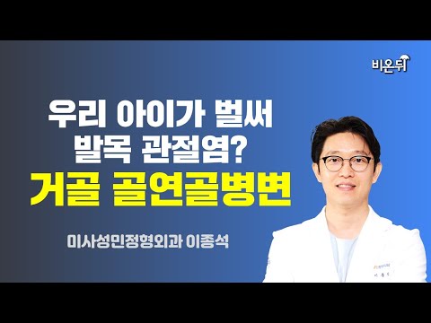 - 거골 <strong>골연골병변</strong> / 미사성민정형외과 이종석