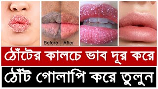 ঠোঁটের কালচে ভাব দূর করে ঠোঁট গোলাপি করে তুলুন ।। Baby pink lips।। Beauty tips screenshot 2