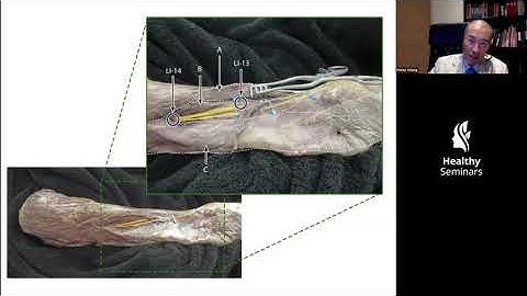 Neuro-Meridian Integrative Acupuncture: Upper Extremity - Update, by Poney Chiang