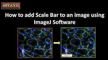 How to add Scale Bar to an image using ImageJ Software