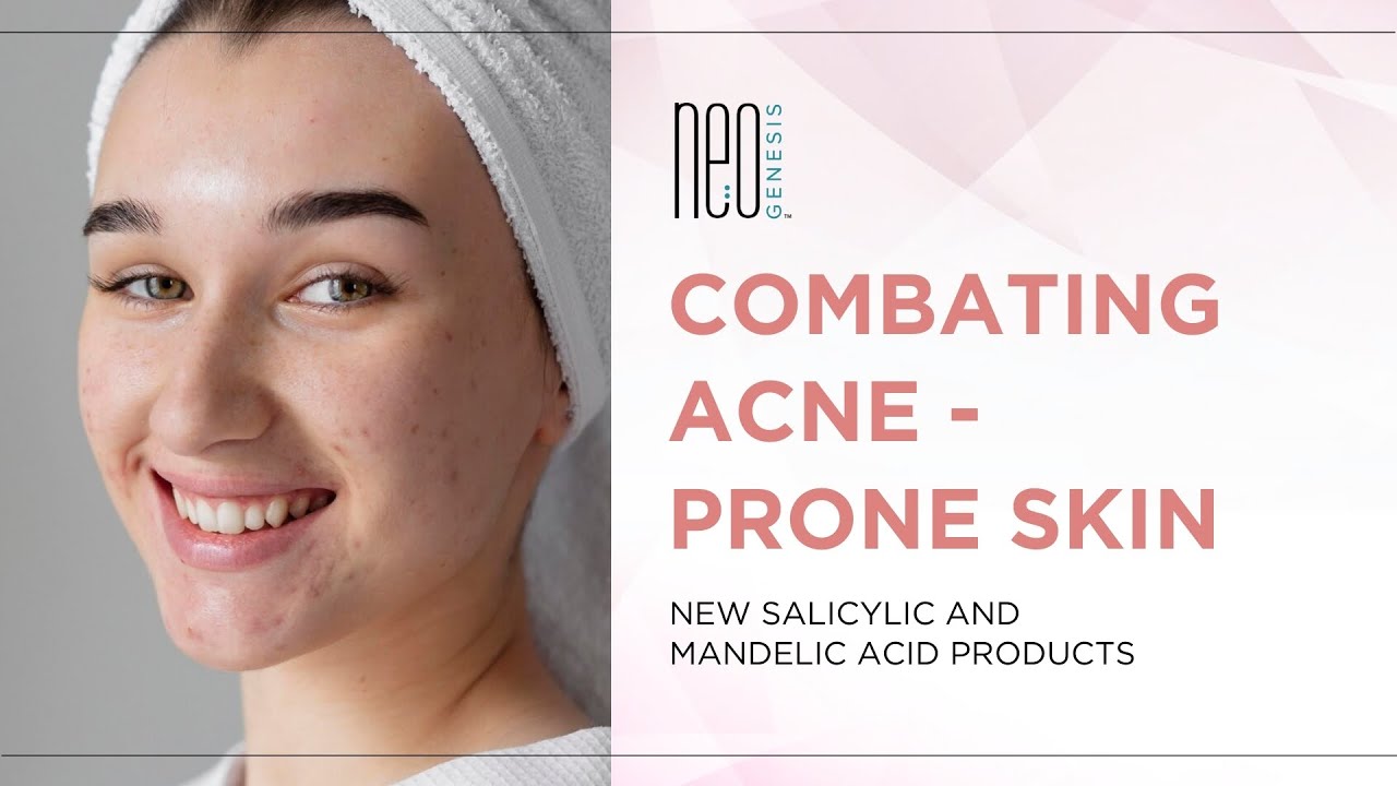 Combating AcneProne Skin New Salicylic and Mandelic Acid Products