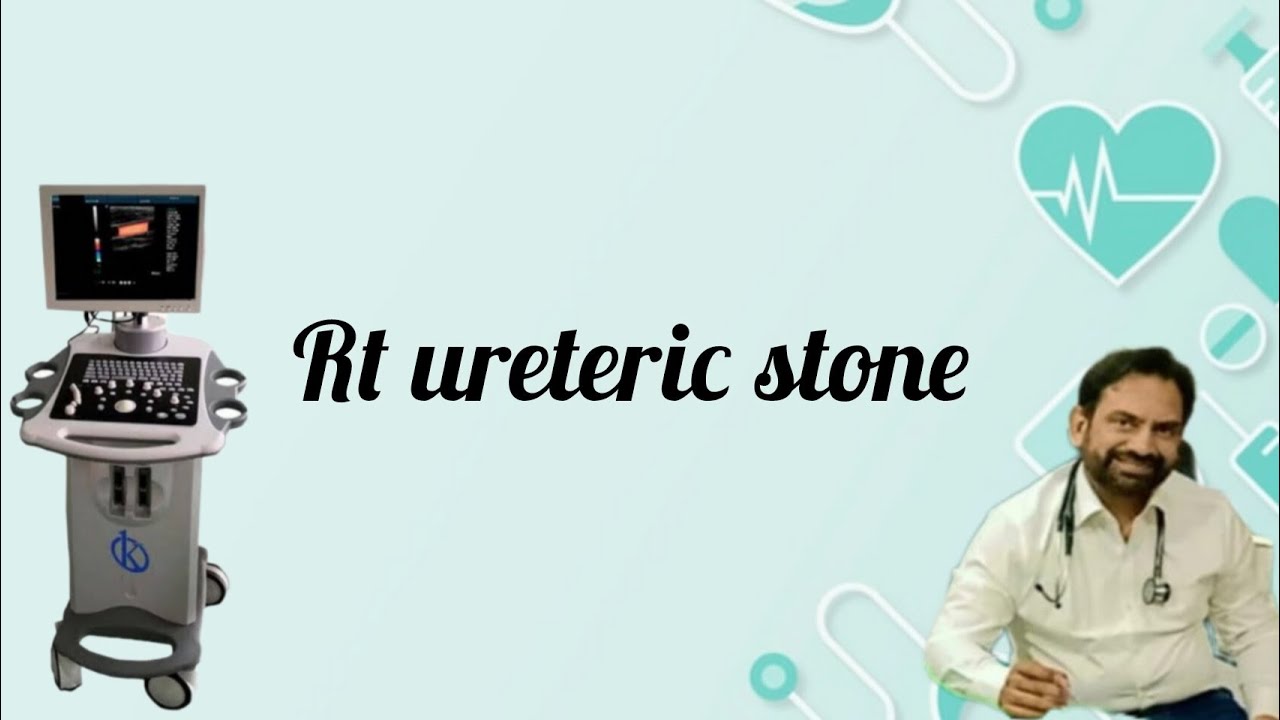 Rt ureteric stone and urine jet on ultrasound YouTube