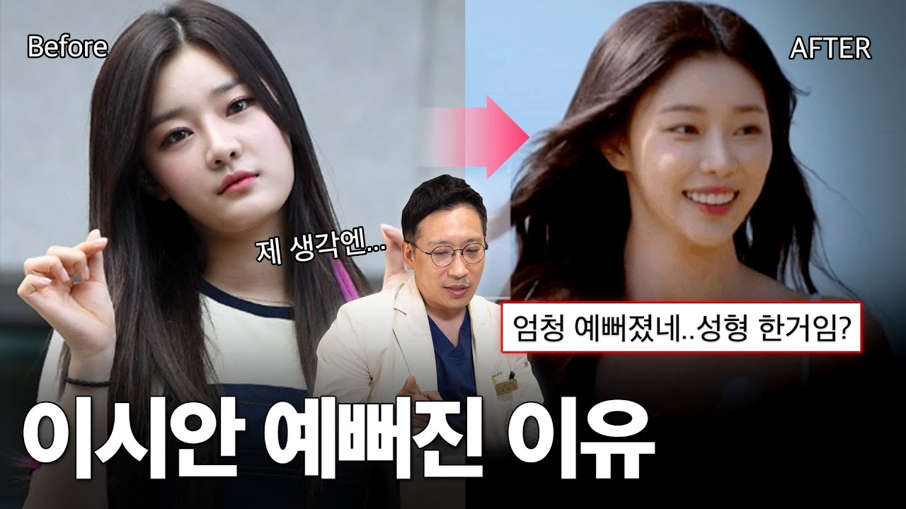 솔로지옥 이시안 윤곽수술 성공 비결은?✨ 무조건 많이 깎는다고 좋은 게 아닙니다💦