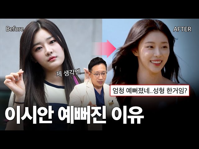솔로지옥 이시안 윤곽수술 성공 비결은?✨ 무조건 많이 깎는다고 좋은 게 아닙니다💦
