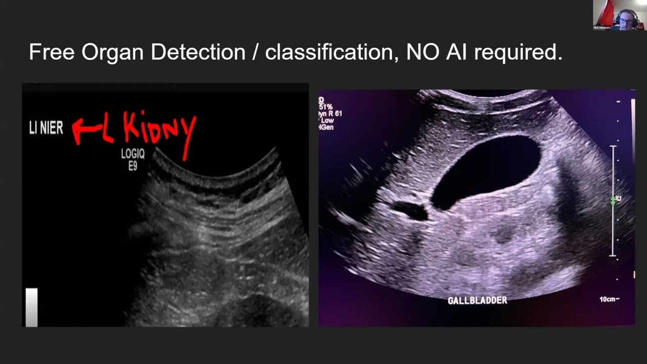 2022 SIIM Hackathon Project 4 - Screen Scraper