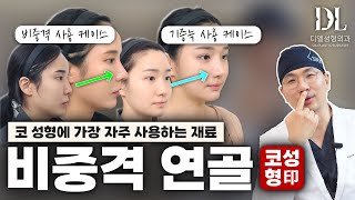 코수술시 비중격연골만 사용해도될까? 추가 연골이 필요한 경우는 ? #코성형