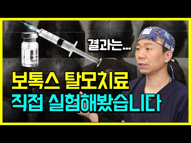 보톡스로 탈모치료! 그 효과는 어느 정도일까?|뉴헤어