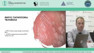 Профилактика ВПЧ инфекции и плоскоклеточного рака полового члена (Борисов П.С.)