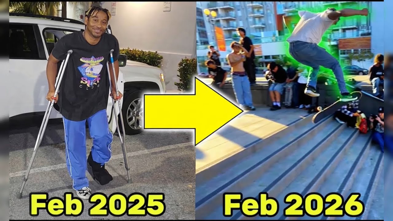 My 1 Year Skate Progression After A Broken Leg