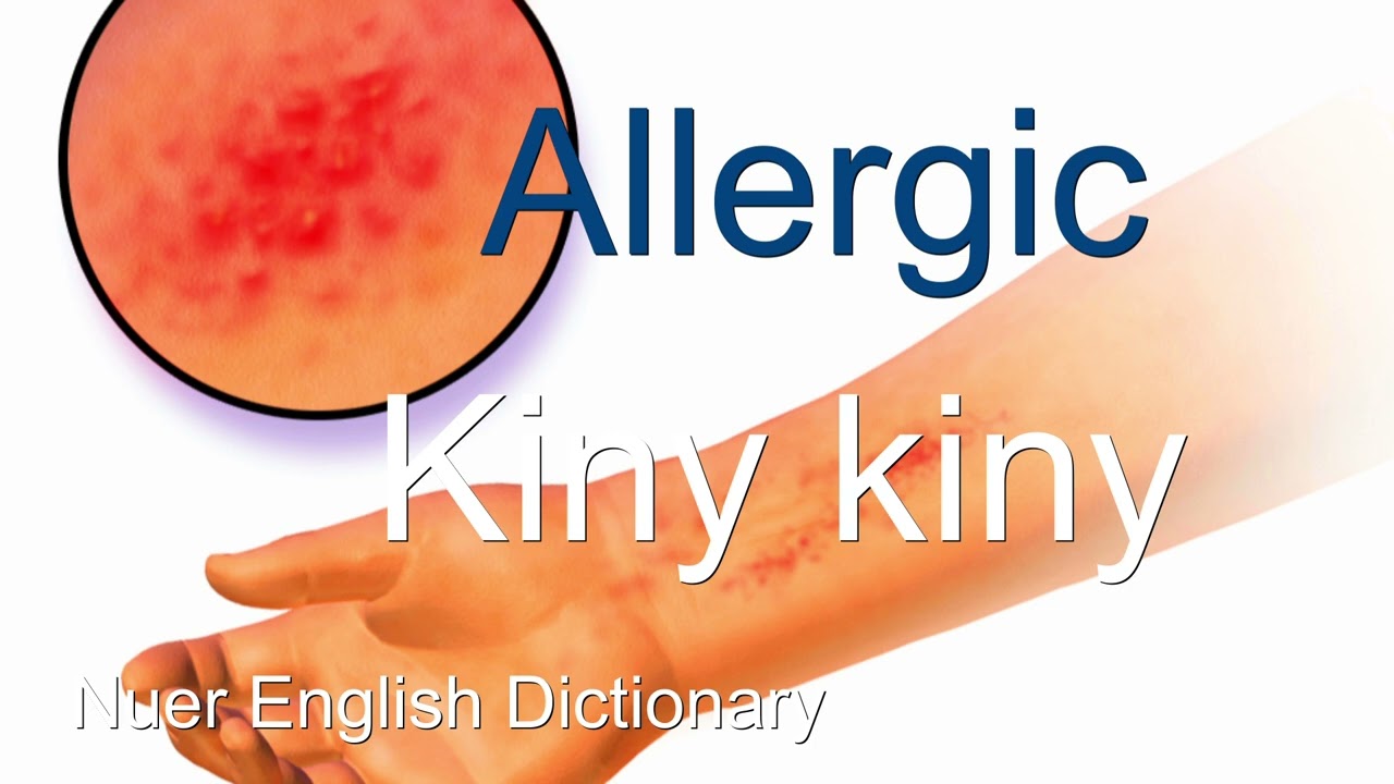 meaning of allergic in nuer language